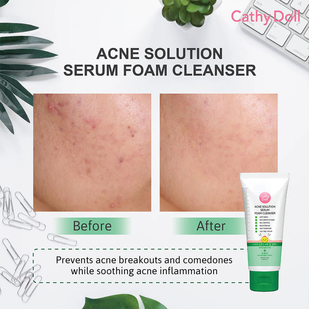 Cathy Doll Acne Solution Serum Foam Cleanser